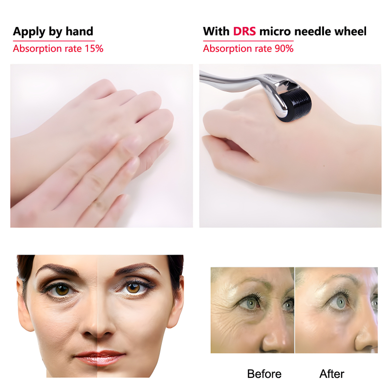 Pack of 2 – 0.5mm Derma Roller Microneedle Set | Professional Skin Care & Massage Tools for Home Use